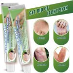 ZULANGZHONG Dermophyte Clearing Cream - Image 5